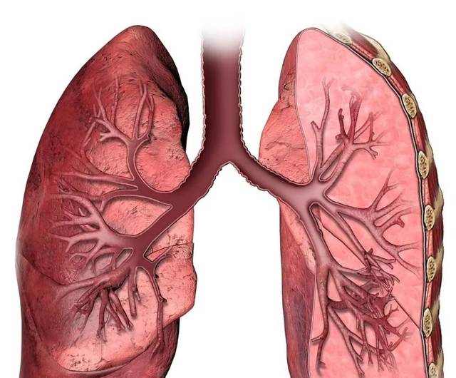 肺癌早期症状表现图片